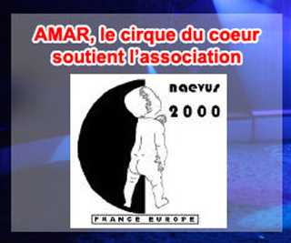 Le cirque Amar partenaire de l'association Naevus 2000 France Europe